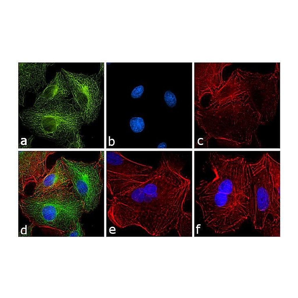 Thermo Fisher Scientific Goat anti-Rat IgG (H+L) Secondary Antibody, FITC