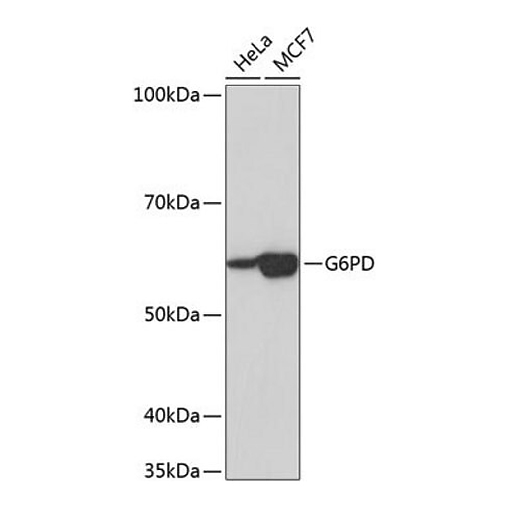 Merck Anti-G6PD antibody produced in rabbit