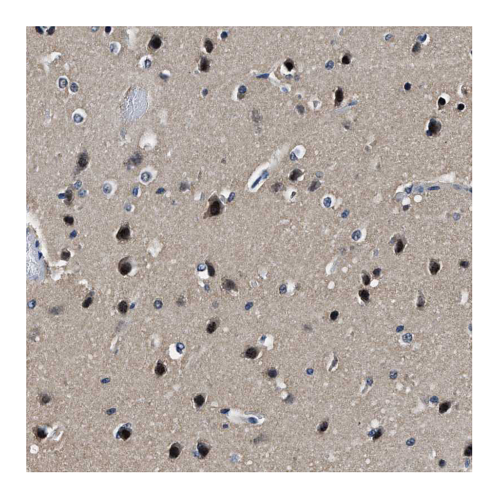Atlas Antibodies Anti-LANCL2 Antibody