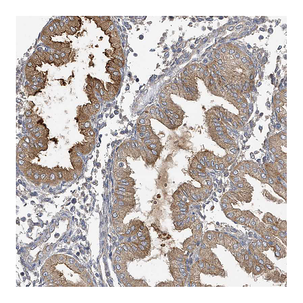 Atlas Antibodies Anti-LAPTM4A Antibody