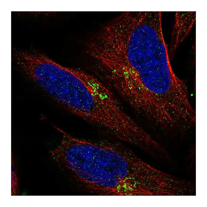 Atlas Antibodies Anti-LAPTM4B Antibody