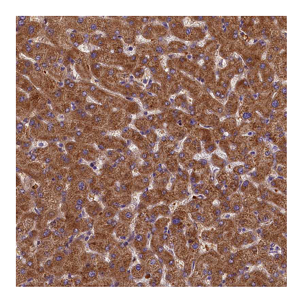 Atlas Antibodies Anti-LARP4 Antibody