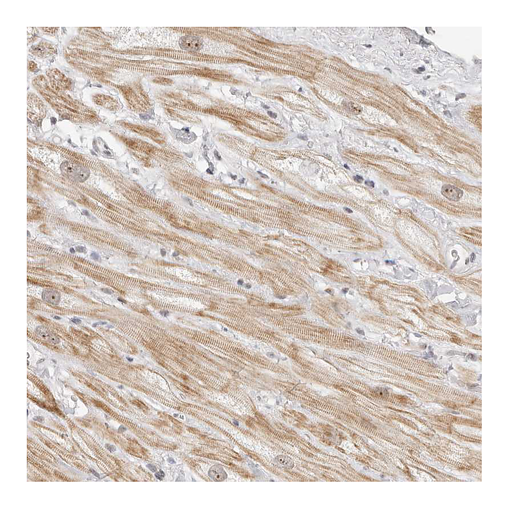 Atlas Antibodies Anti-LARP7 Antibody