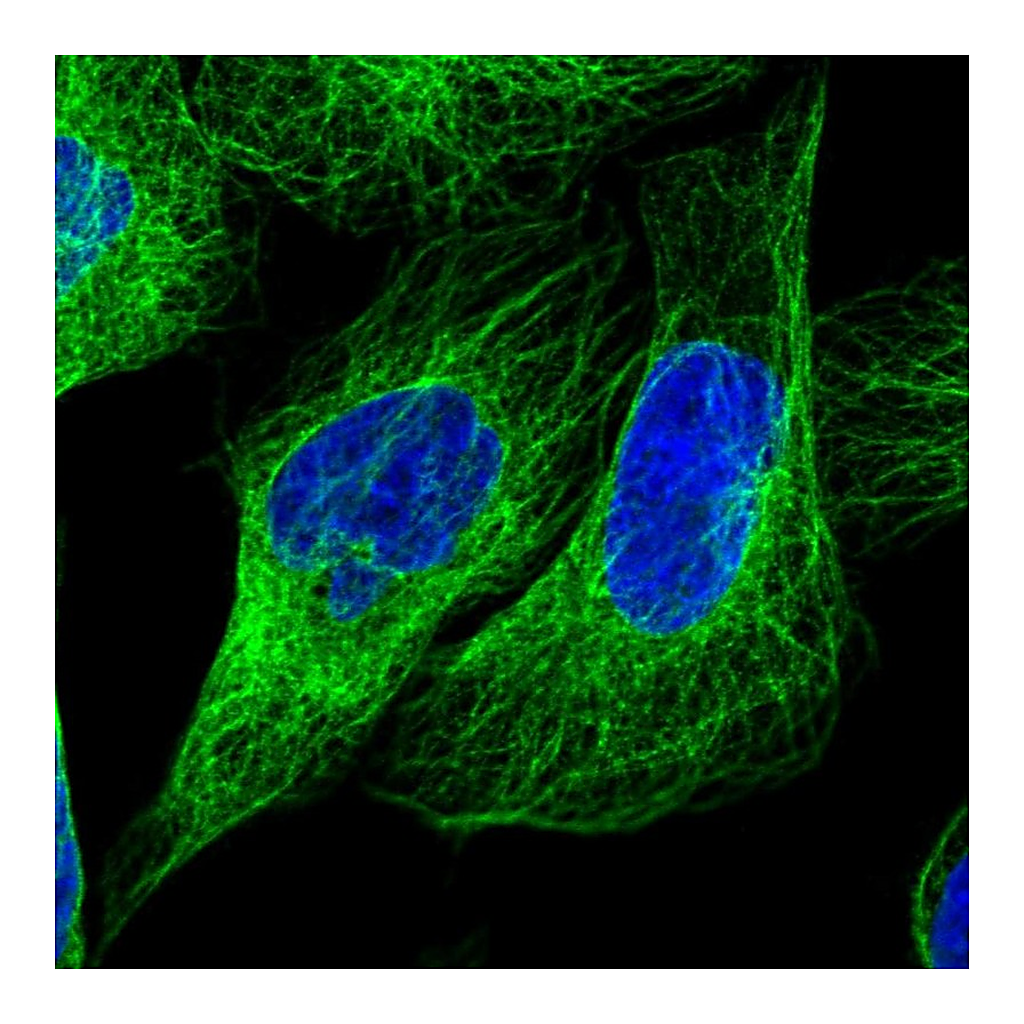 Atlas Antibodies Anti-LARP6 Antibody