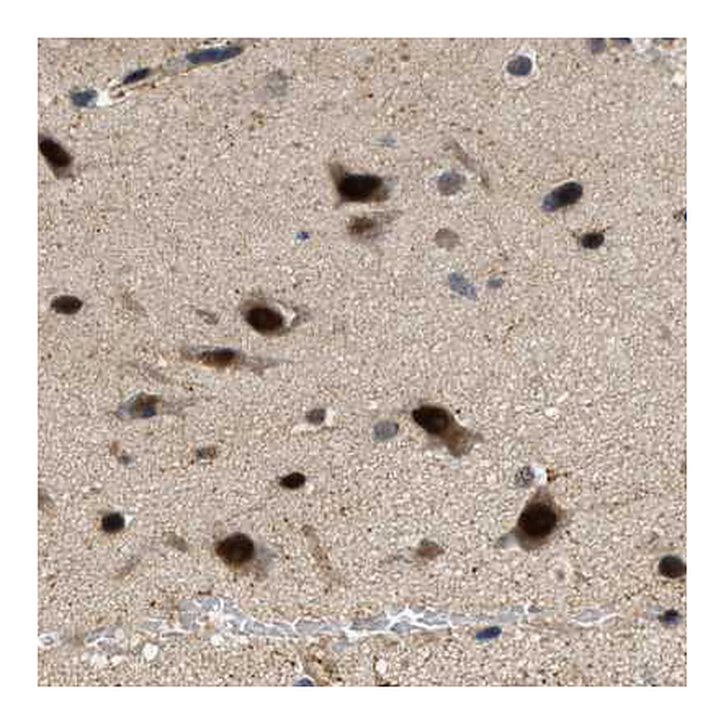 Atlas Antibodies Anti-LARP6 Antibody