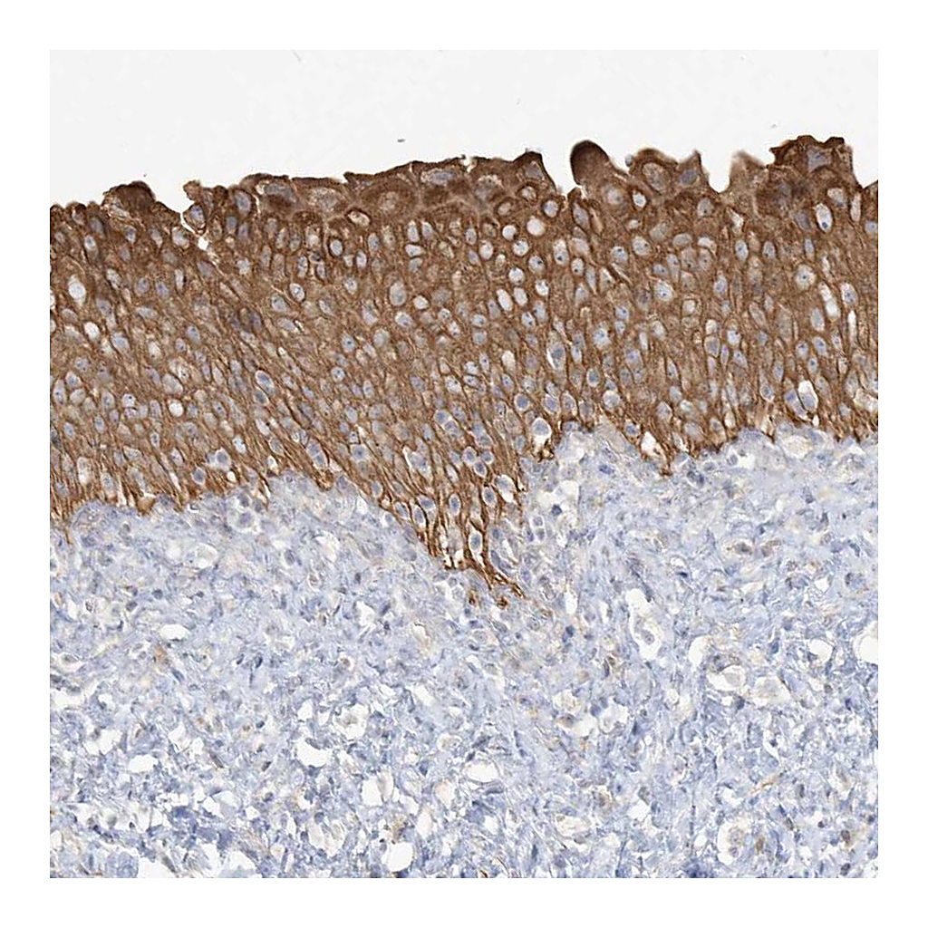 Atlas Antibodies Anti-LARS Antibody
