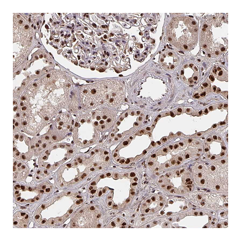 Atlas Antibodies Anti-LAS1L Antibody