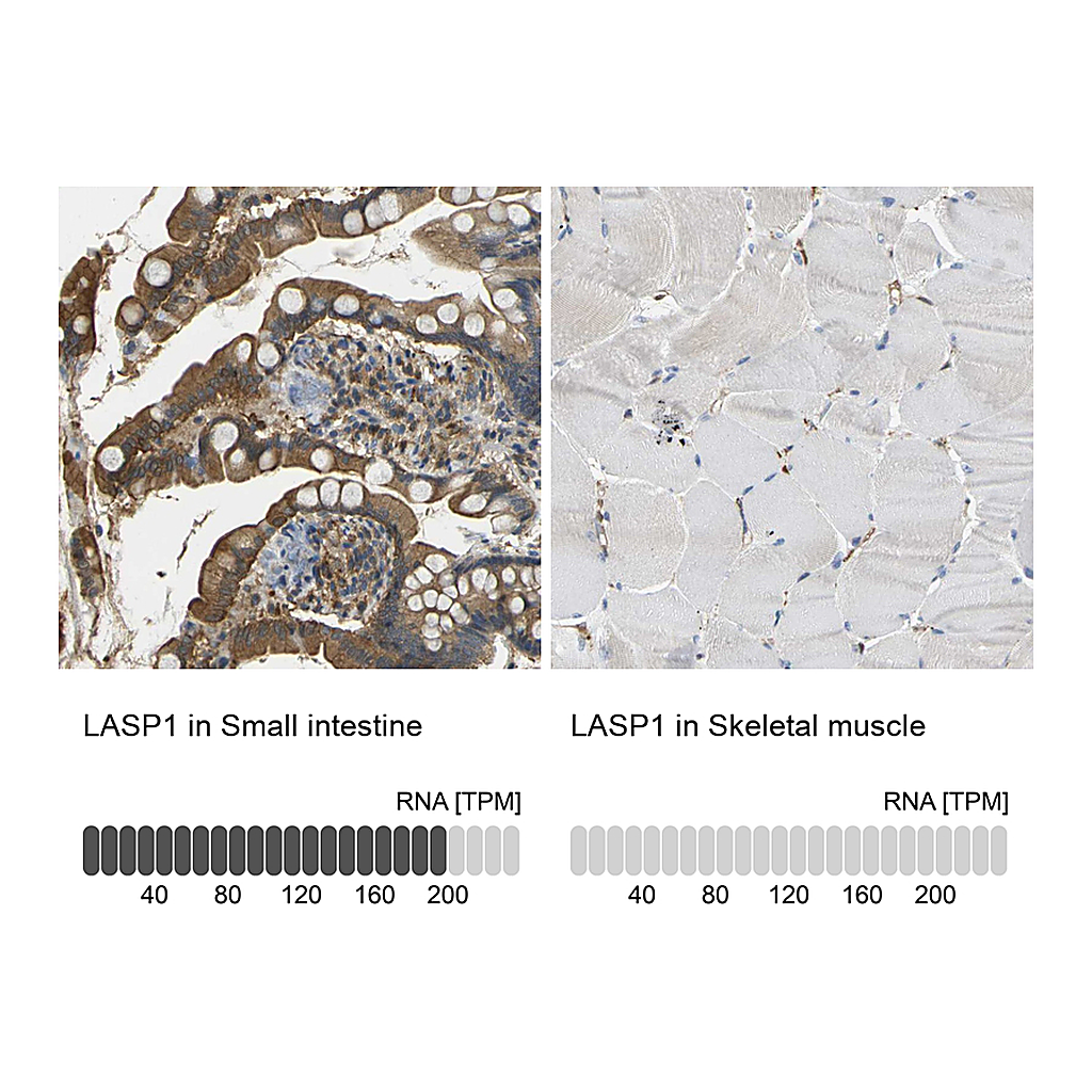 Atlas Antibodies Anti-LASP1 Antibody