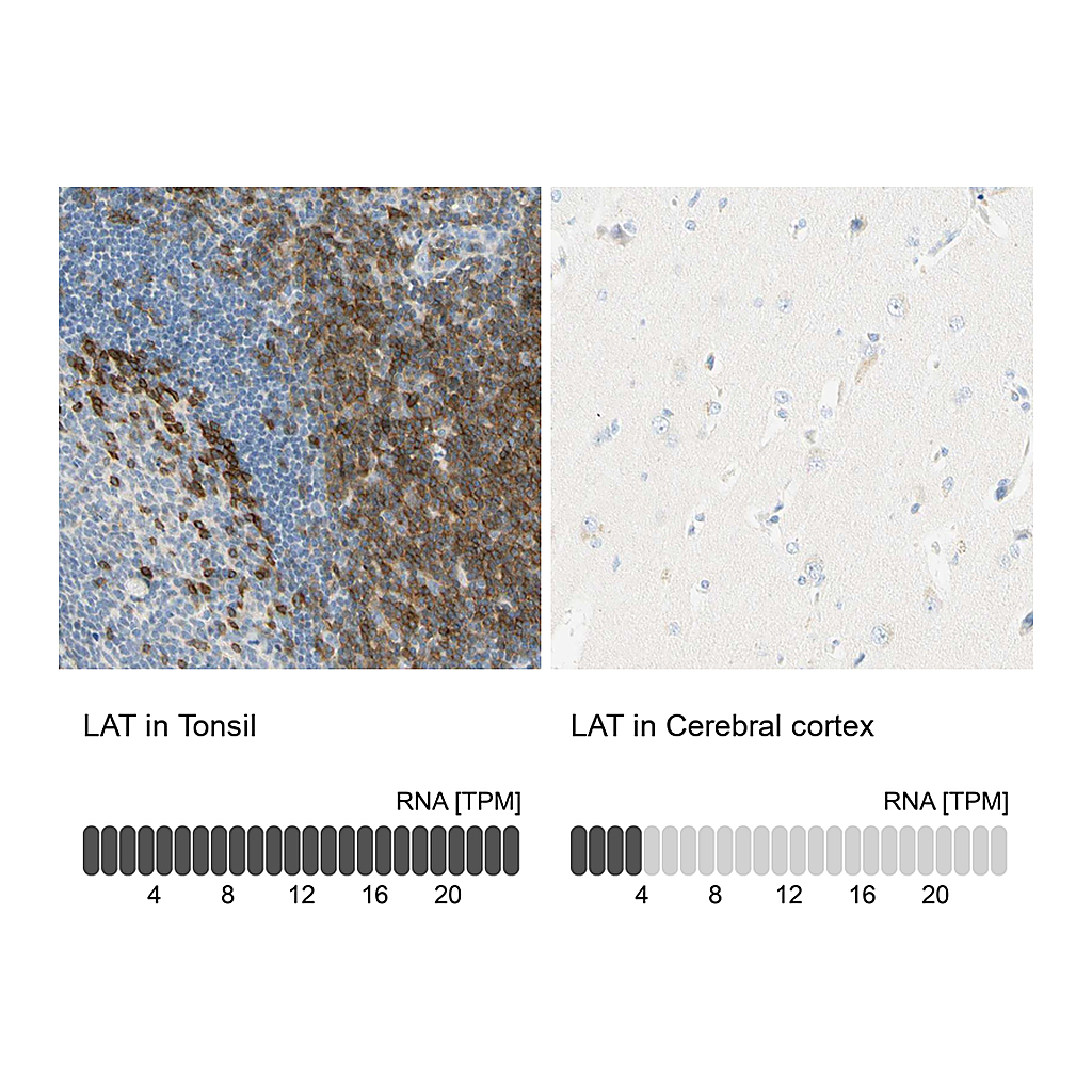 Atlas Antibodies Anti-LAT Antibody