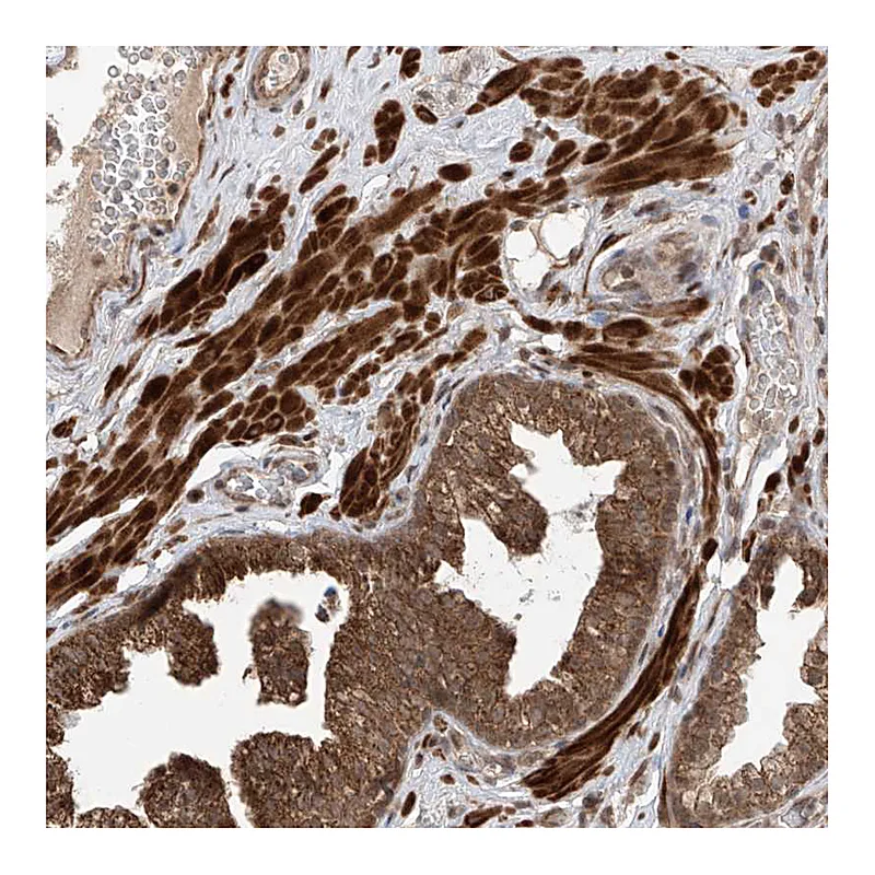 Atlas Antibodies Anti-LATS1 Antibody