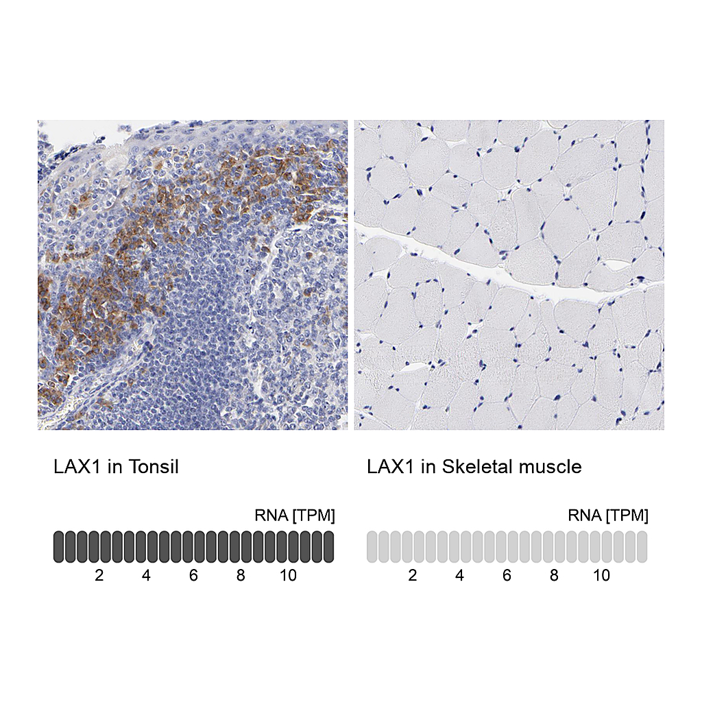 Atlas Antibodies Anti-LAX1 Antibody
