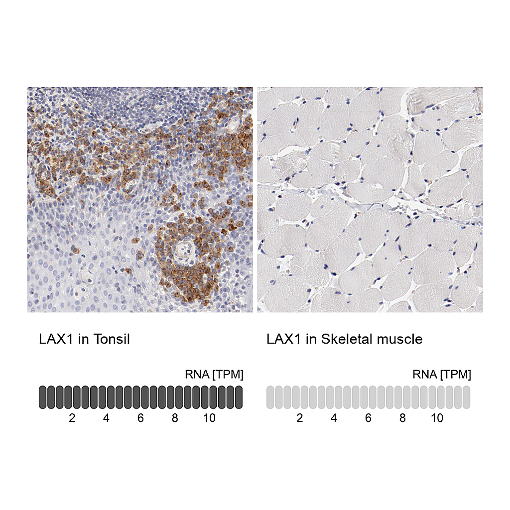 Atlas Antibodies Anti-LAX1 Antibody