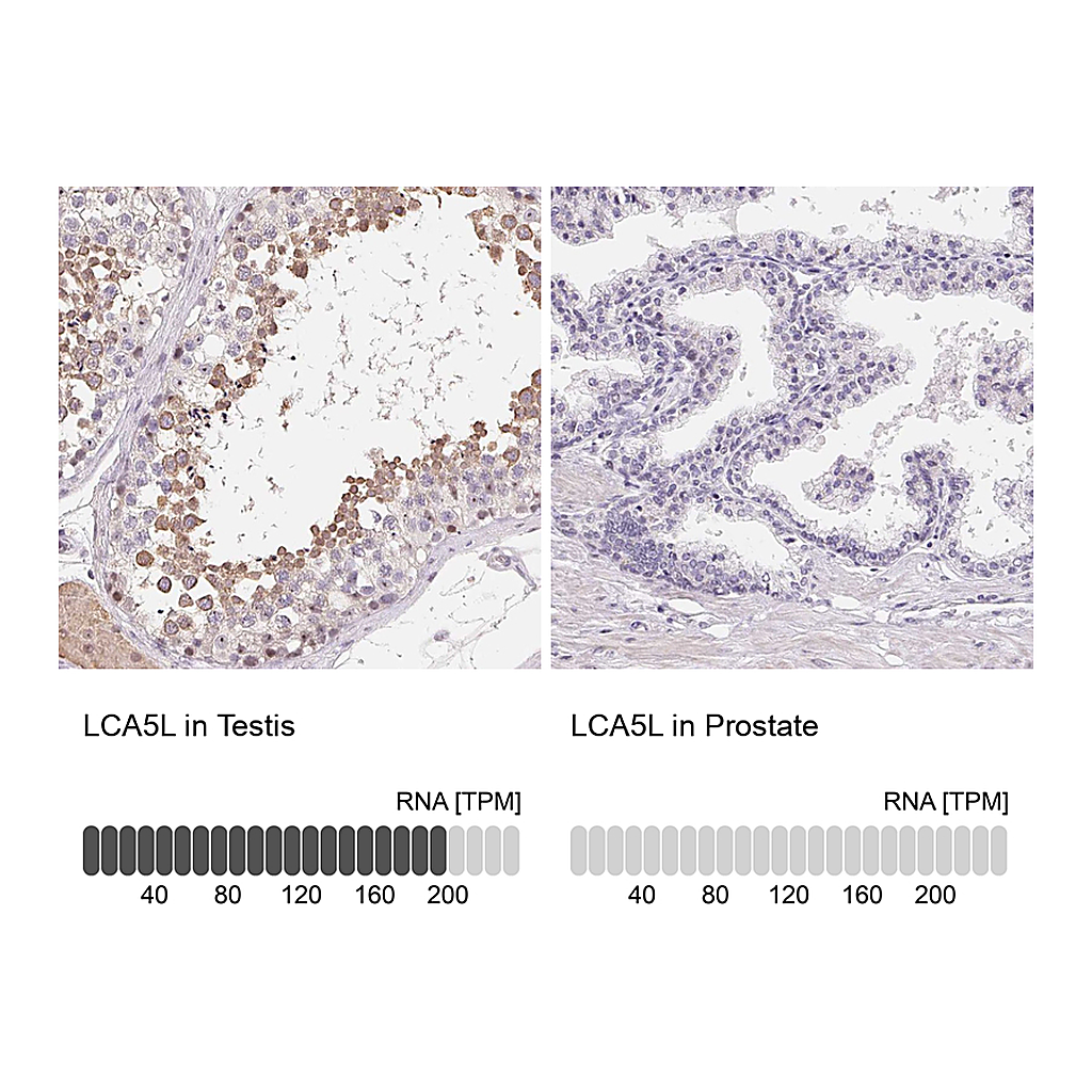 Atlas Antibodies Anti-LCA5L Antibody