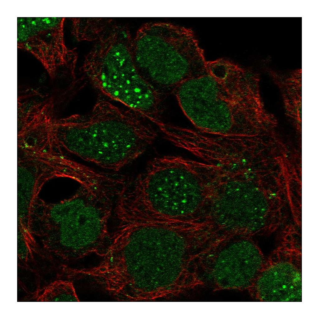 Atlas Antibodies Anti-LBX1 Antibody