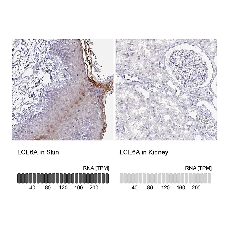 Atlas Antibodies Anti-LCE6A Antibody