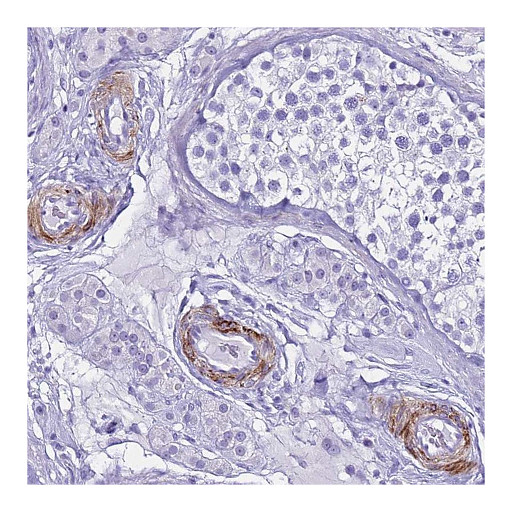 Atlas Antibodies Anti-LCMT1 Antibody