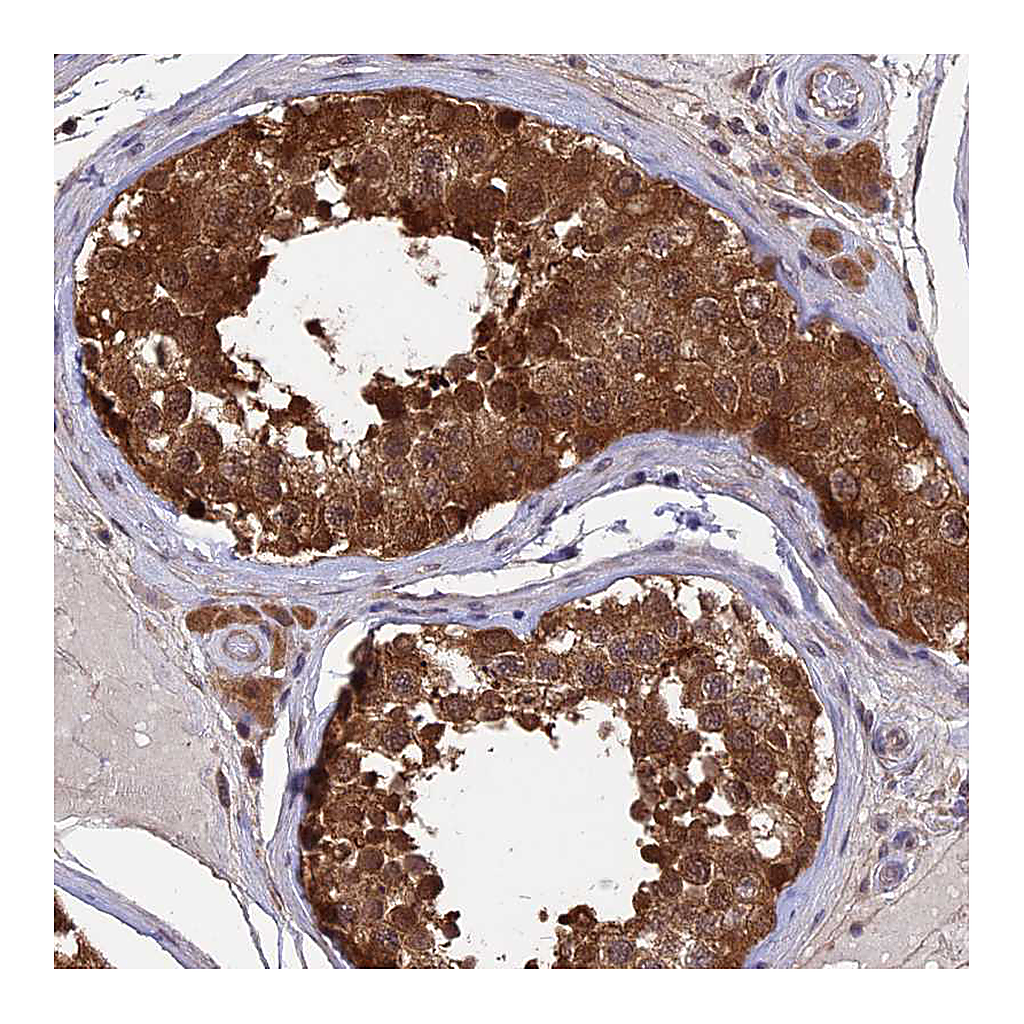 Atlas Antibodies Anti-LCMT1 Antibody
