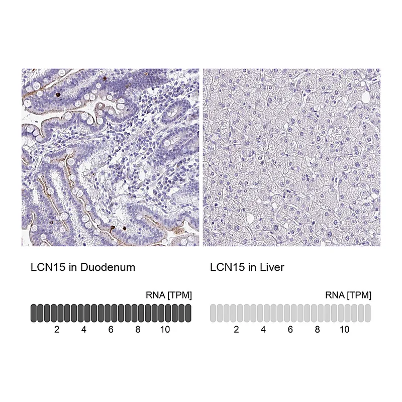Atlas Antibodies Anti-LCN15 Antibody
