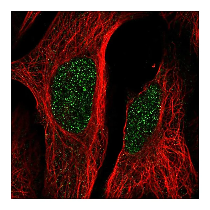 Atlas Antibodies Anti-LCOR Antibody