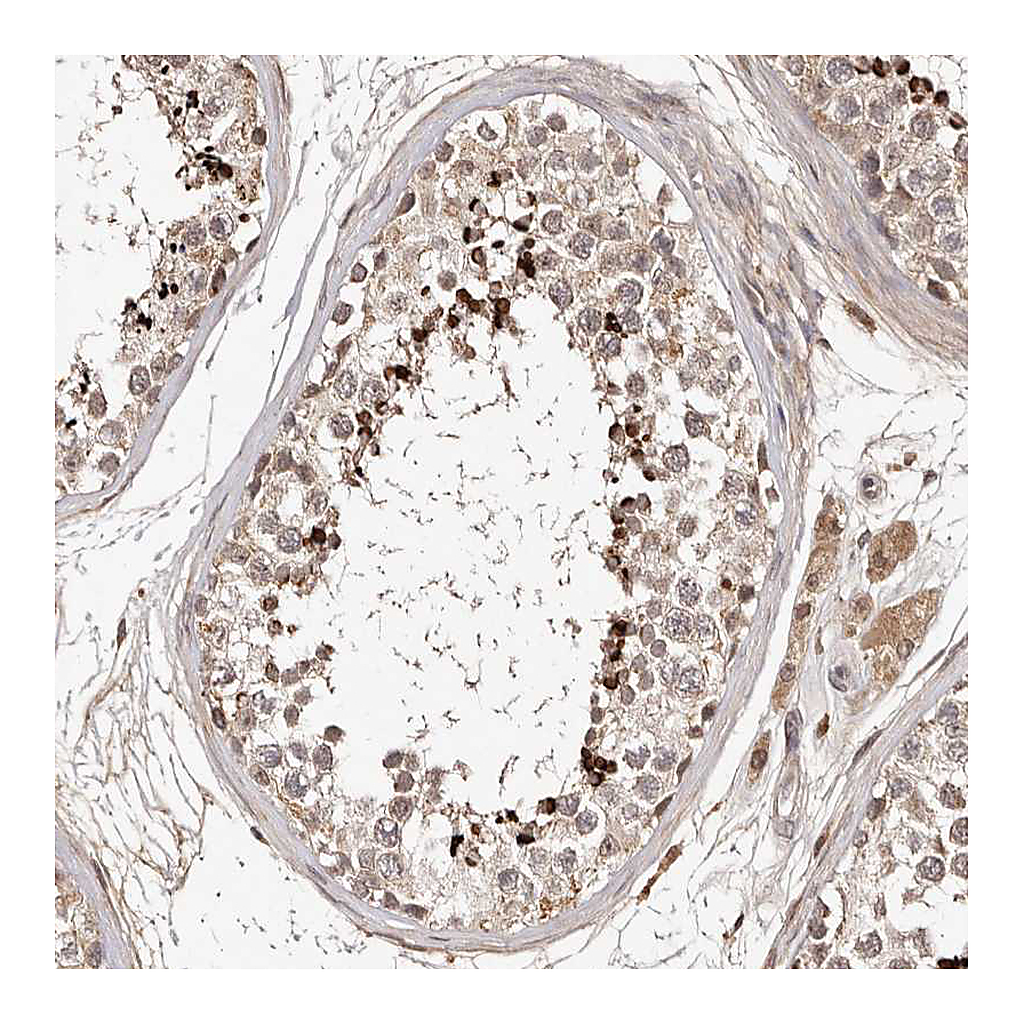 Atlas Antibodies Anti-LCORL Antibody