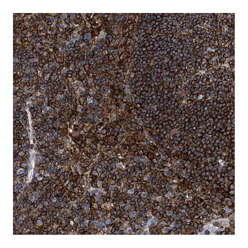 Atlas Antibodies Anti-LCP1 Antibody