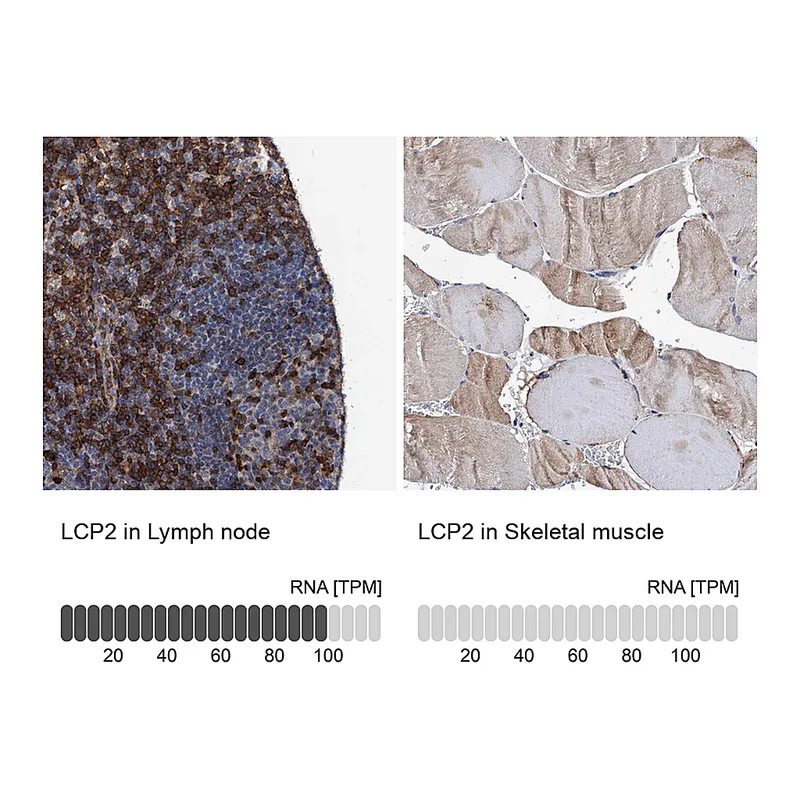 Atlas Antibodies Anti-LCP2 Antibody