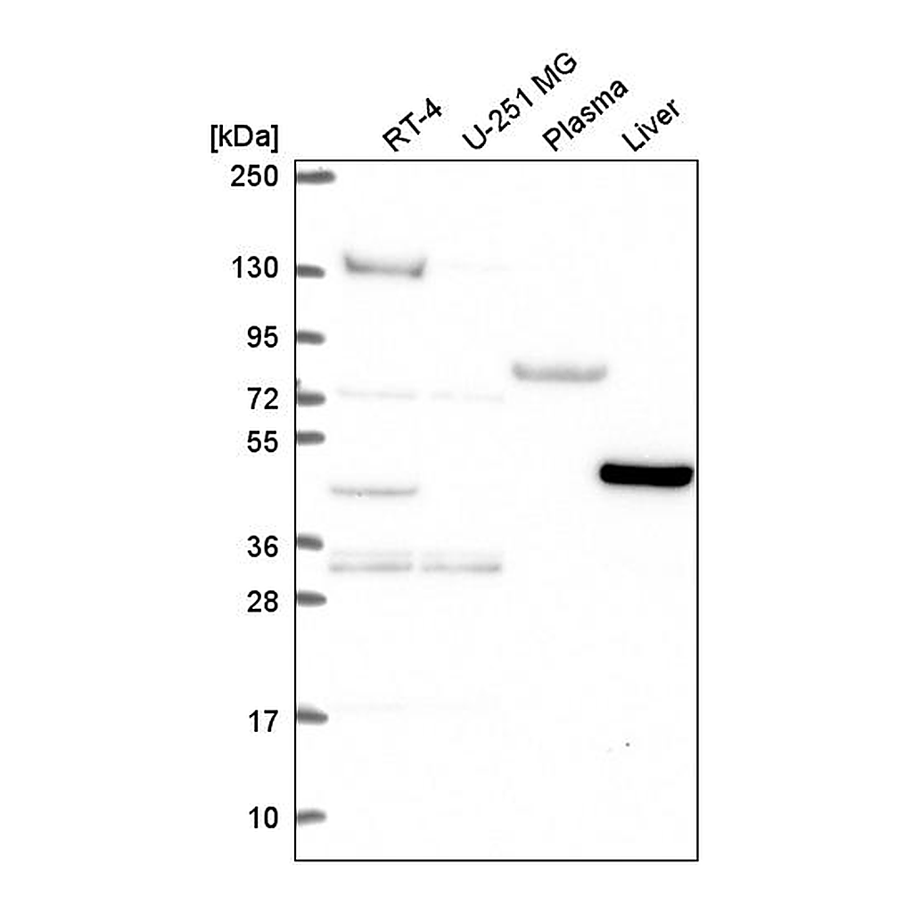 Atlas Antibodies Anti-LDHD Antibody