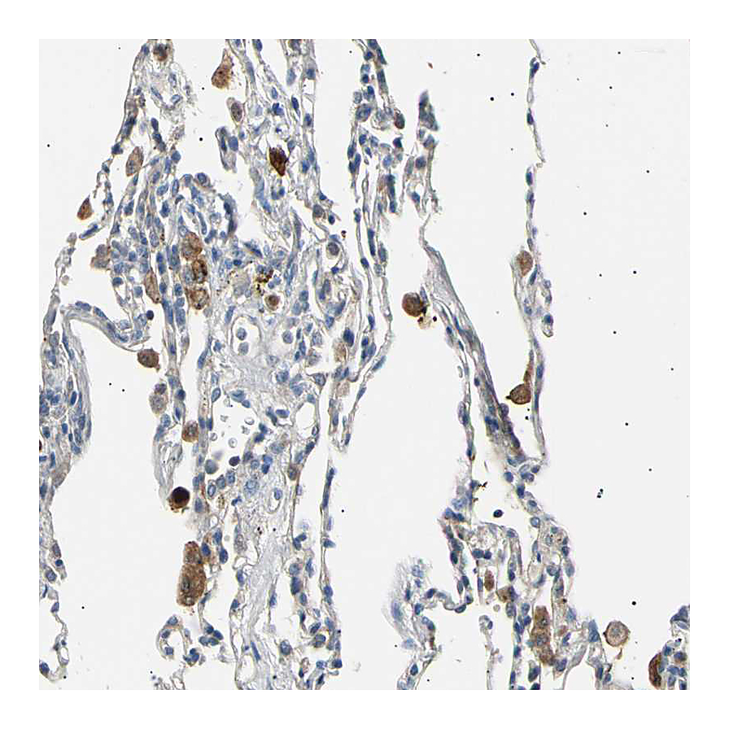 Atlas Antibodies Anti-LDLR Antibody
