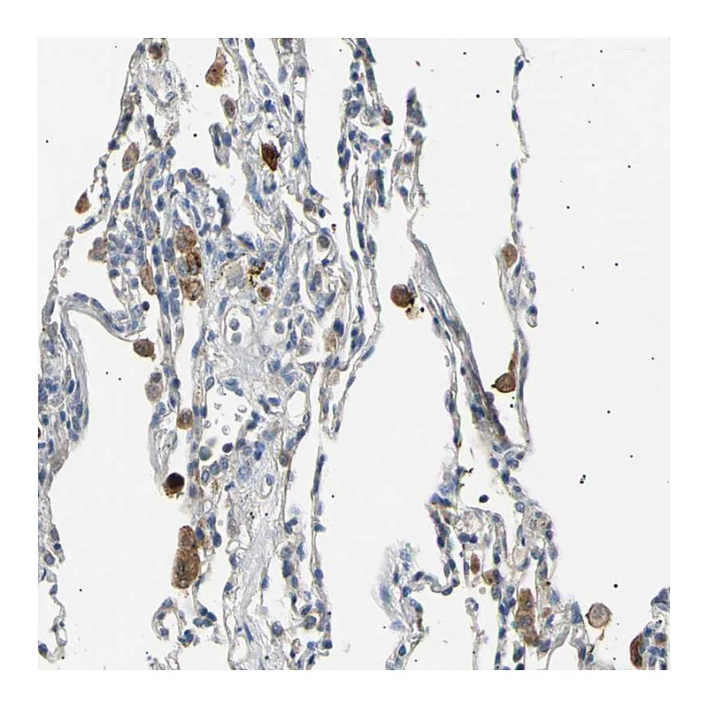 Atlas Antibodies Anti-LDLR Antibody