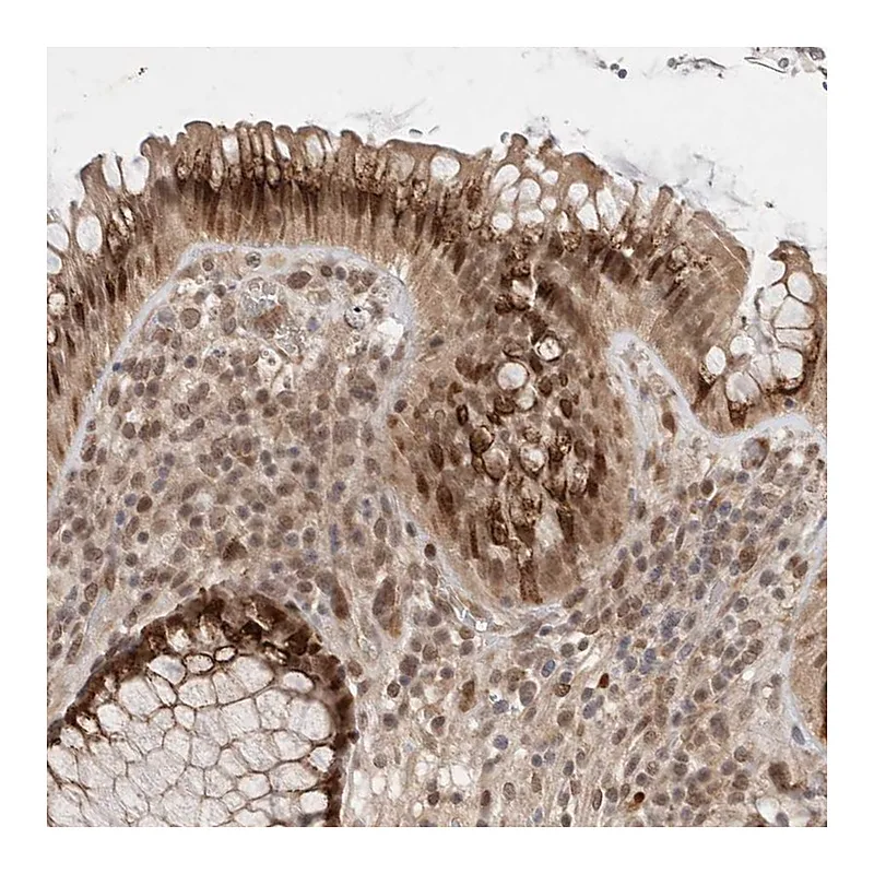 Atlas Antibodies Anti-LEMD3 Antibody