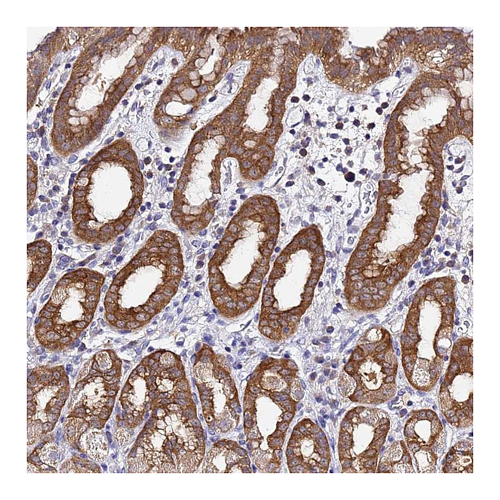 Atlas Antibodies Anti-LENG1 Antibody