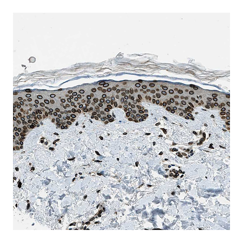 Atlas Antibodies Anti-LEMD2 Antibody