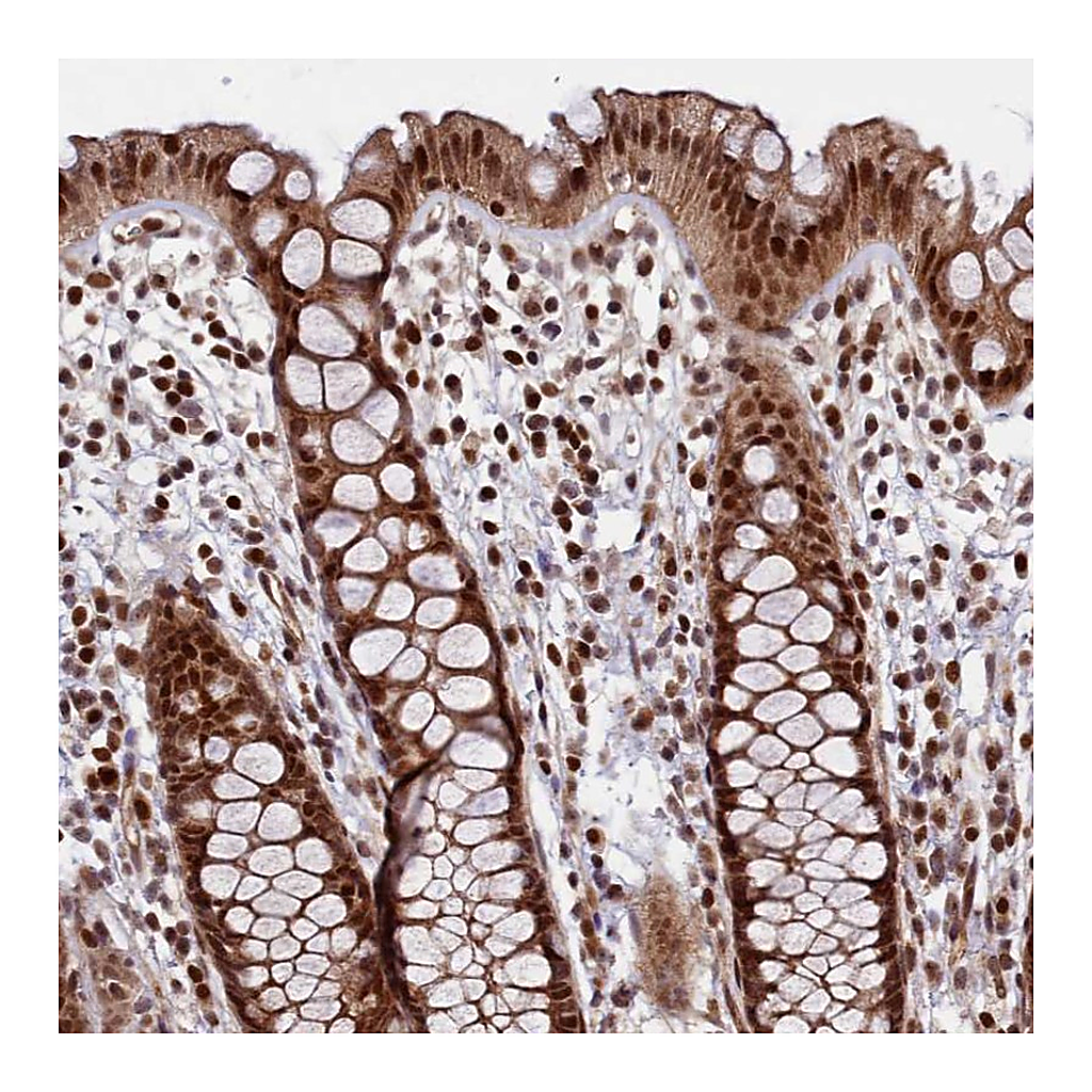 Atlas Antibodies Anti-LEO1 Antibody