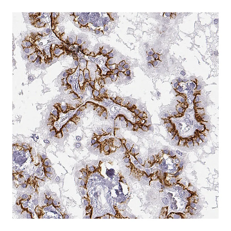 Atlas Antibodies Anti-LEPR Antibody