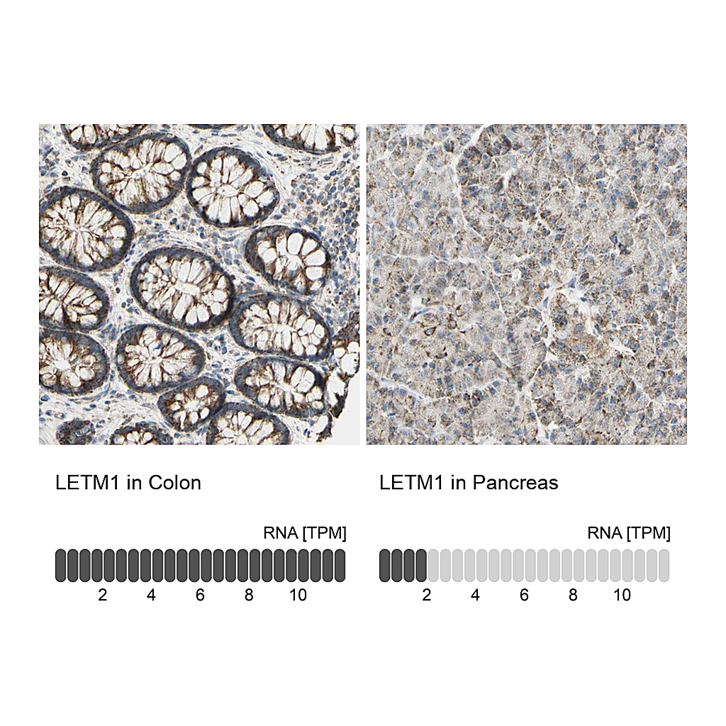 Atlas Antibodies Anti-LETM1 Antibody