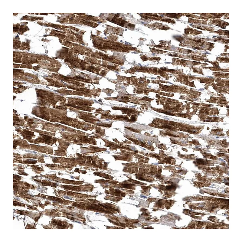 Atlas Antibodies Anti-LEXM Antibody