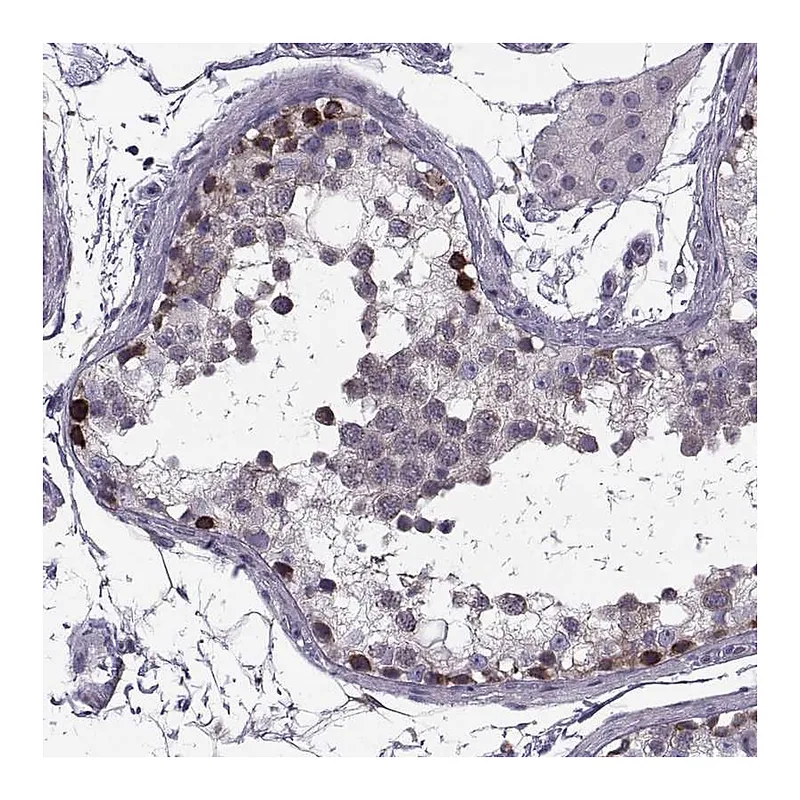 Atlas Antibodies Anti-LETM2 Antibody