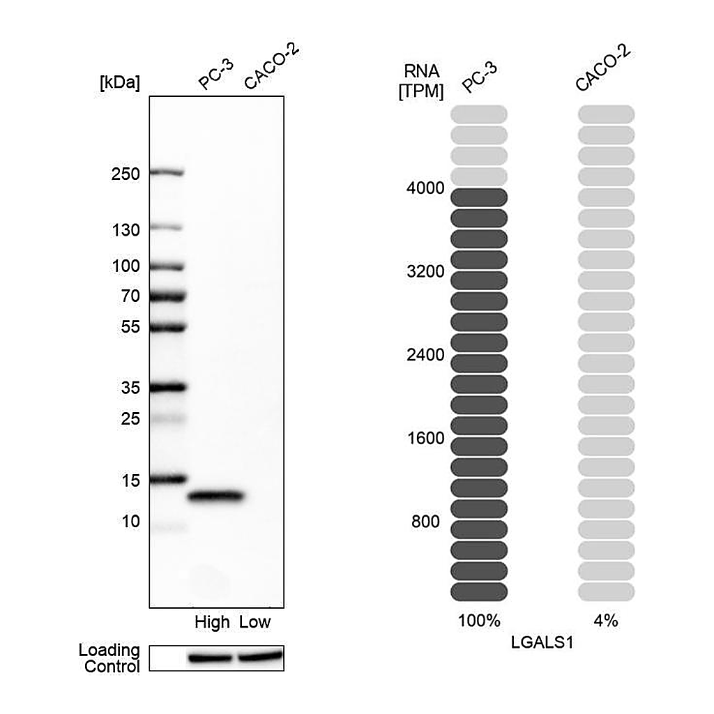 Atlas Antibodies Anti-LGALS1 Antibody