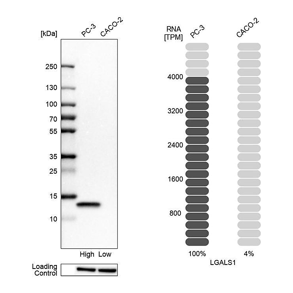 Atlas Antibodies Anti-LGALS1 Antibody