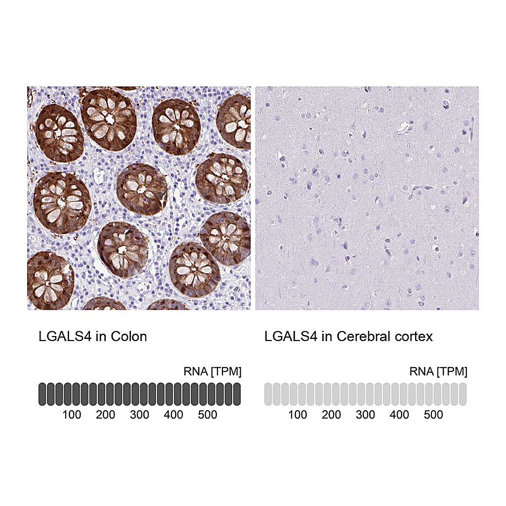 Atlas Antibodies Anti-LGALS4 Antibody
