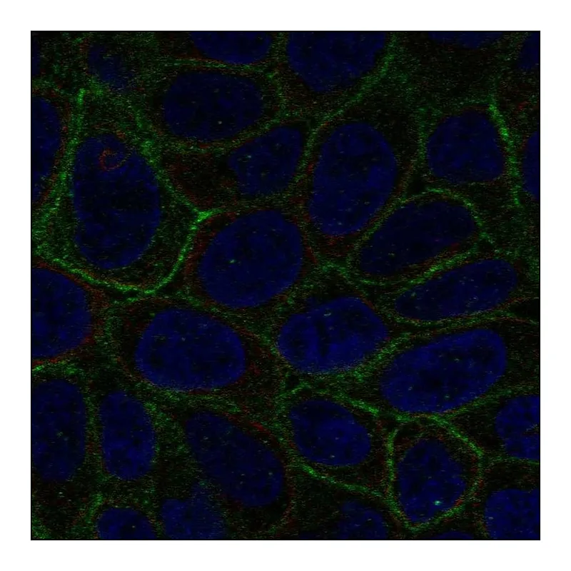Atlas Antibodies Anti-LGALS8 Antibody
