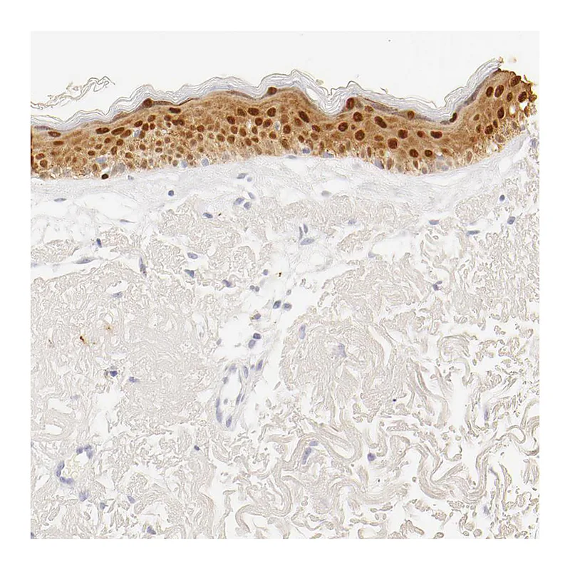 Atlas Antibodies Anti-LGALS7 Antibody