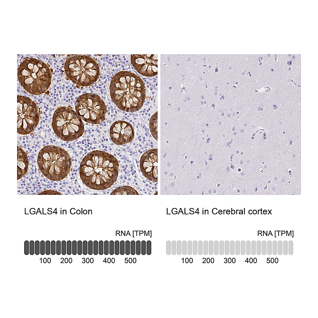 Atlas Antibodies Anti-LGALS4 Antibody