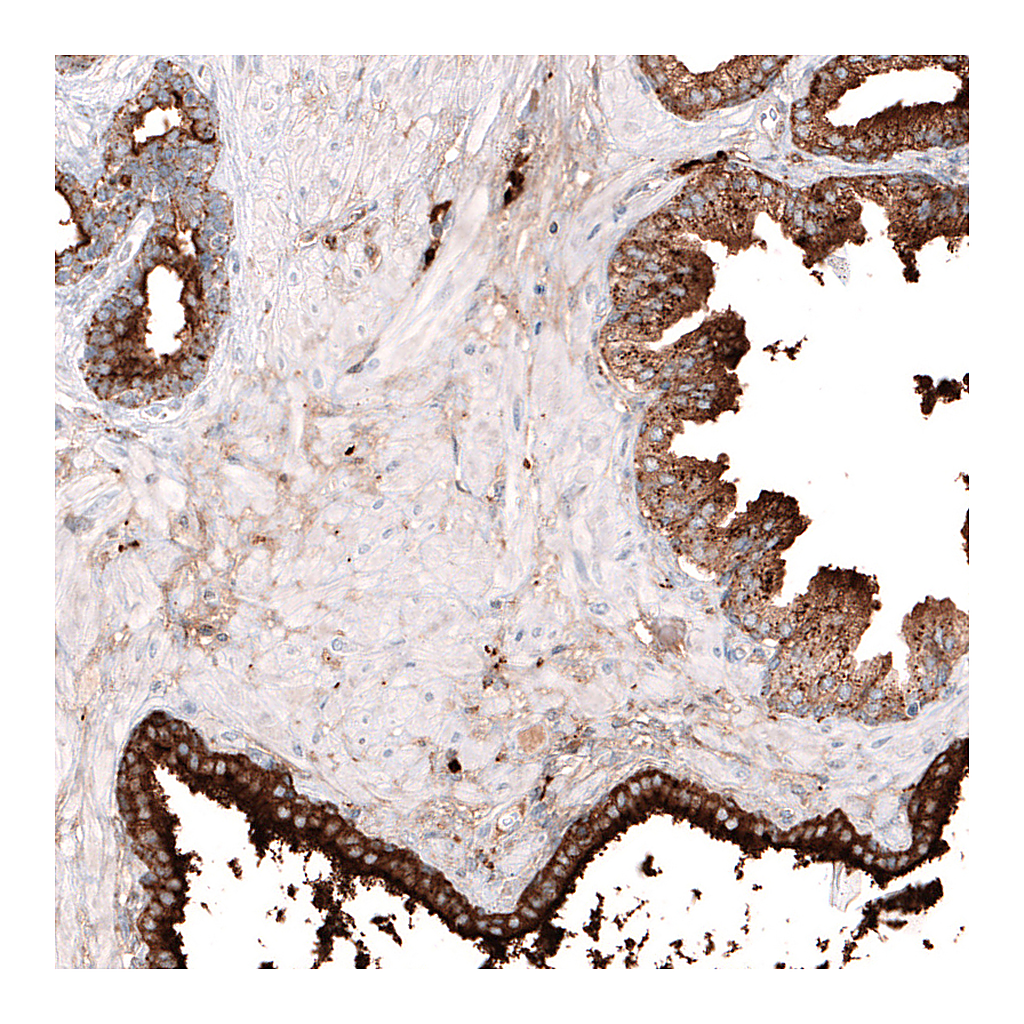 Atlas Antibodies Anti-LGALS3BP Antibody