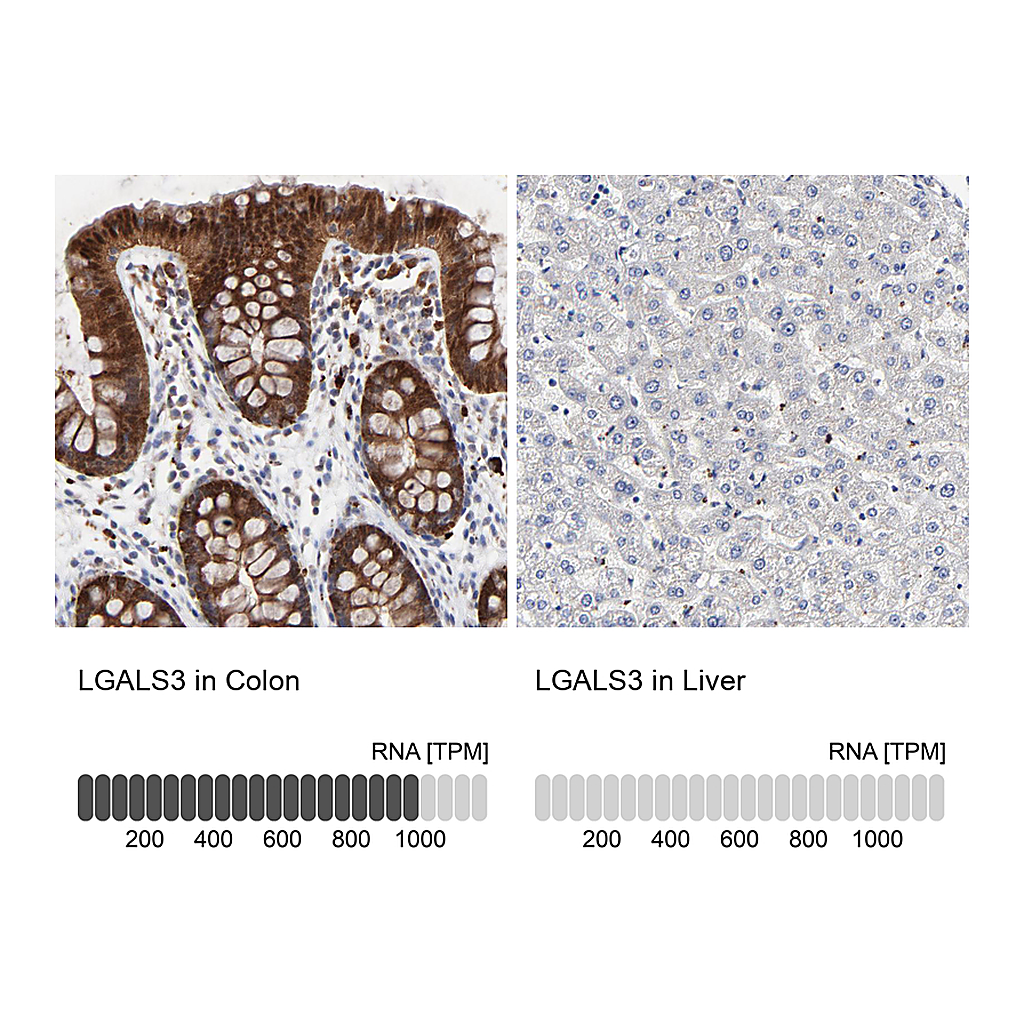 Atlas Antibodies Anti-LGALS3 Antibody