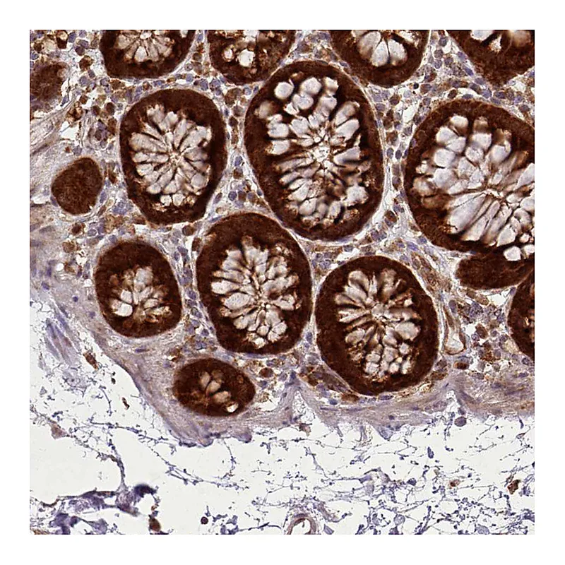 Atlas Antibodies Anti-LGALS9 Antibody