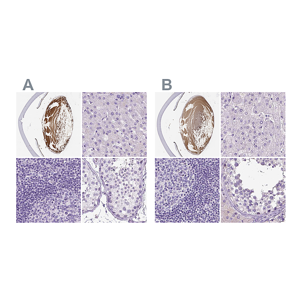 Atlas Antibodies Anti-LGSN Antibody