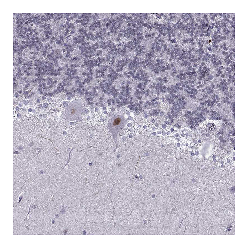 Atlas Antibodies Anti-LHX1 Antibody
