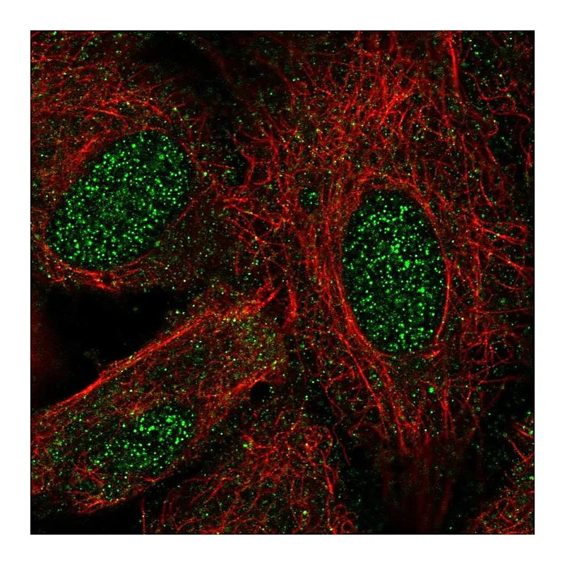 Atlas Antibodies Anti-LHX8 Antibody