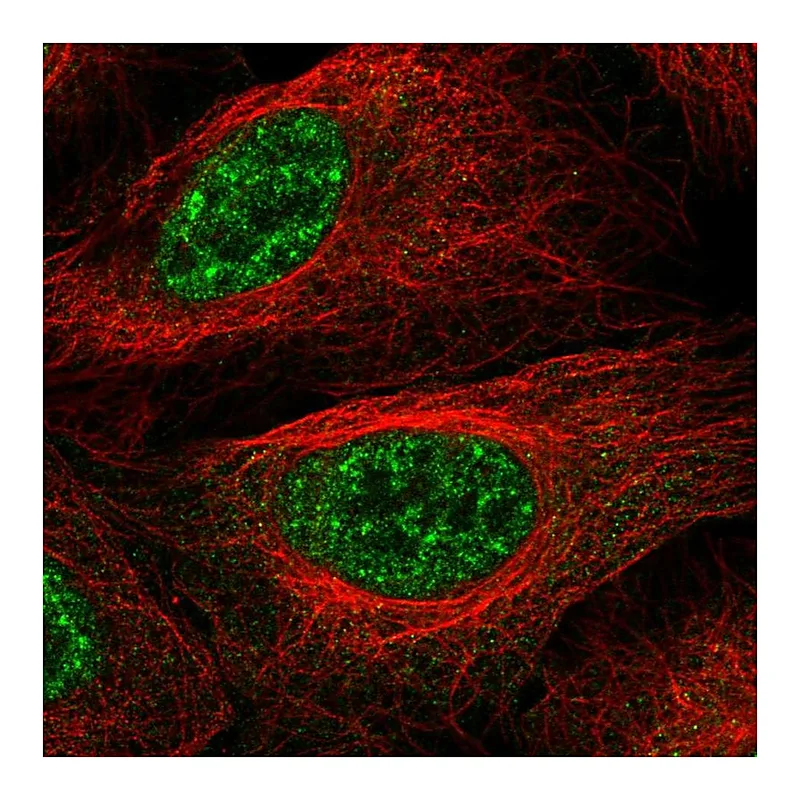 Atlas Antibodies Anti-LHX4 Antibody